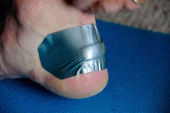 Use Duct Tape to Cover a Blister instead of Bandages