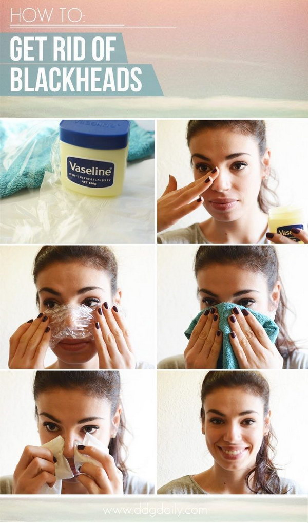 Get Rid of Blackheads with Vaseline and Clear Plastic. 