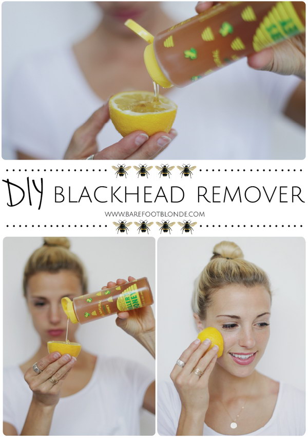 DIY Blackhead Remover Using Honey, Lemon and Sugar. 