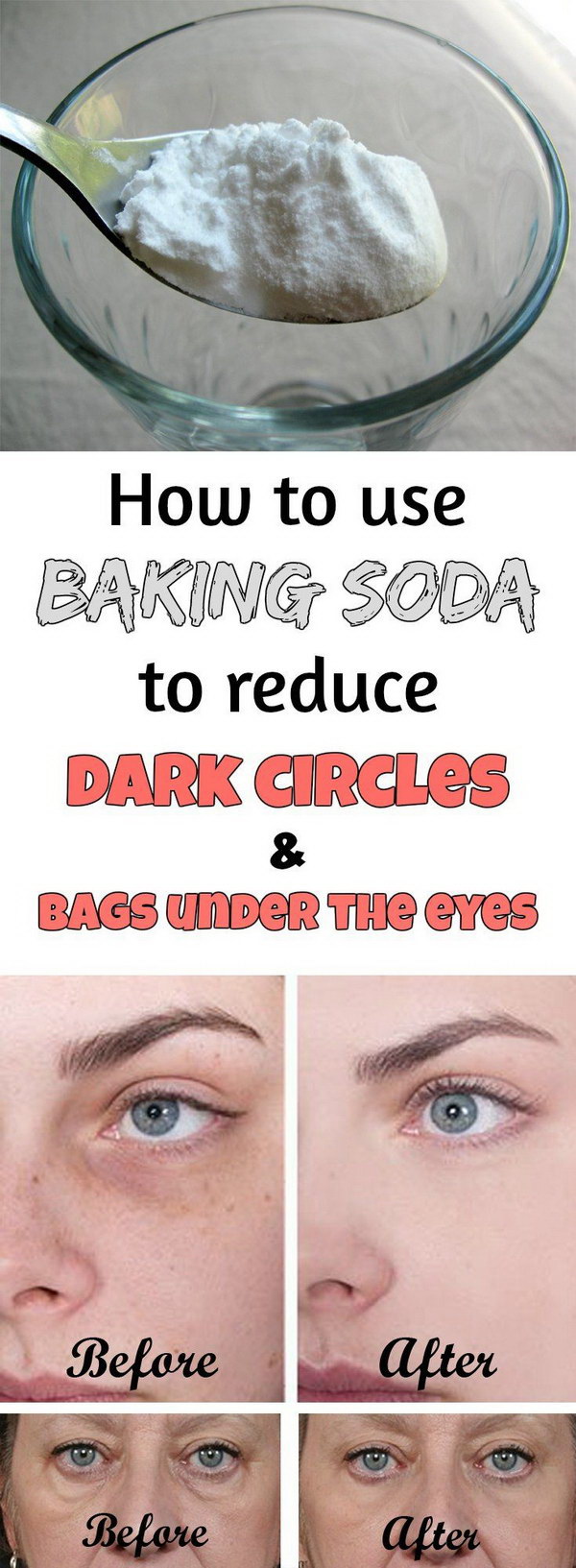 Reduce Dark Circles And Bags Under The Eyes with Baking Soda. 